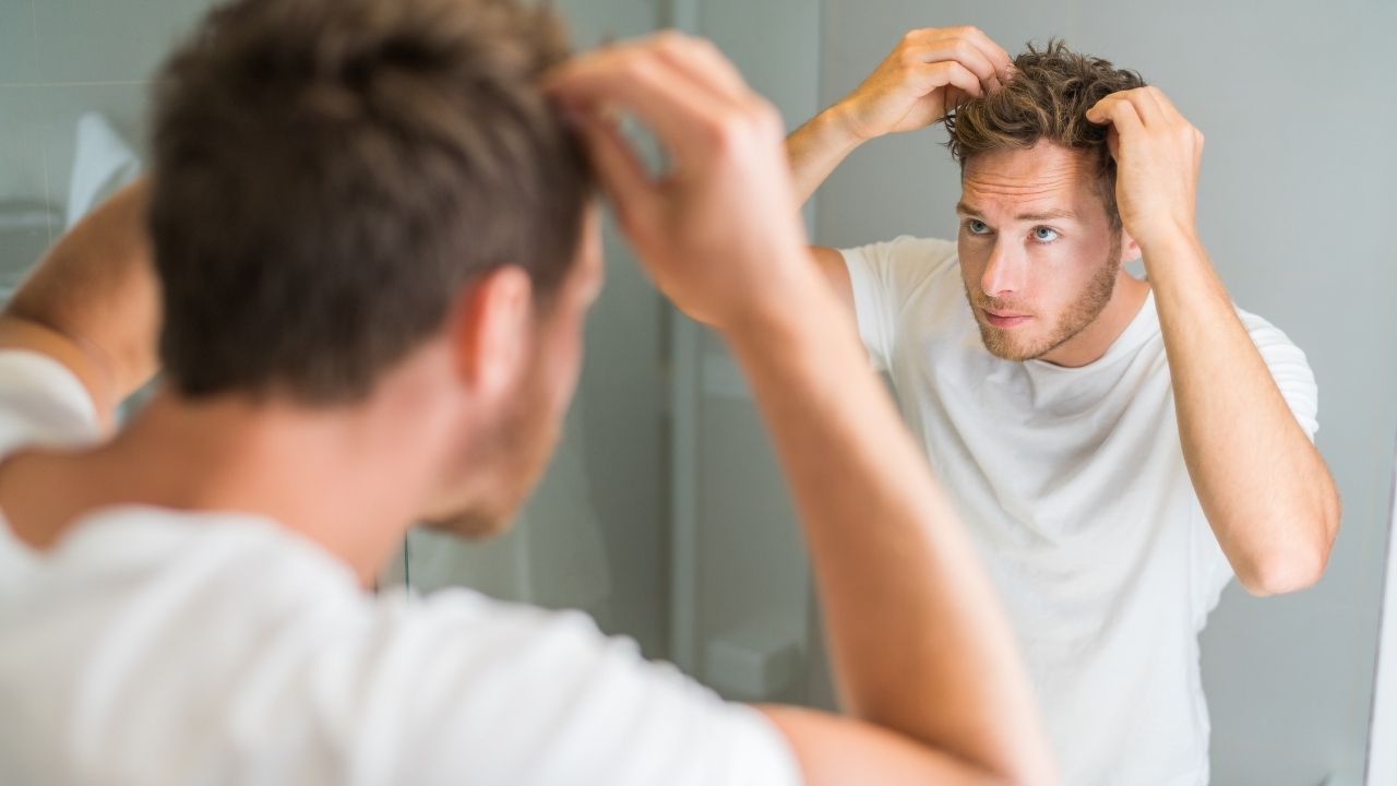 a guy balding