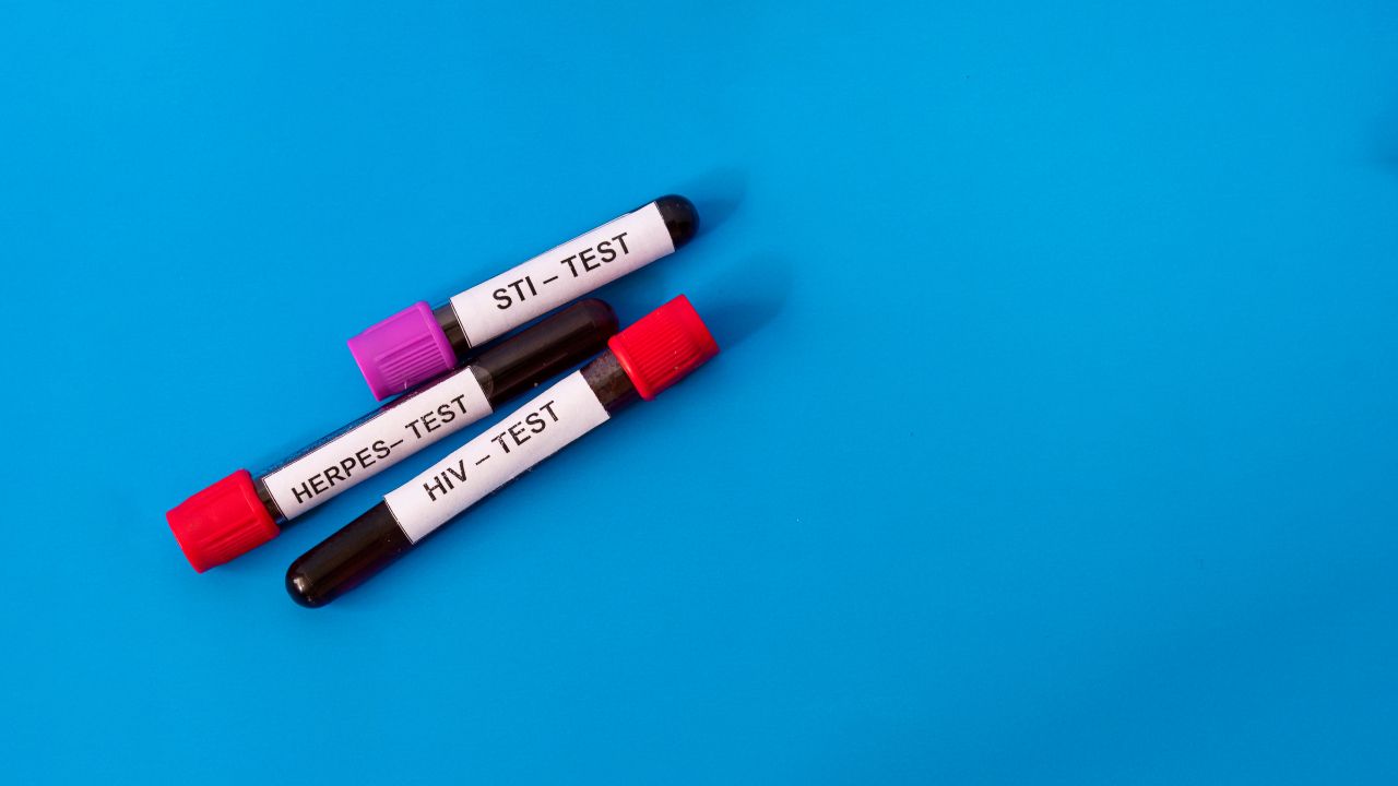 STI sample for testing