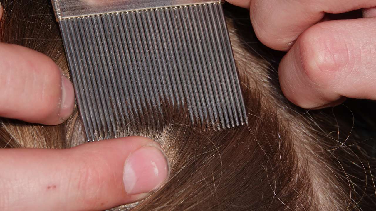 Lice in hair