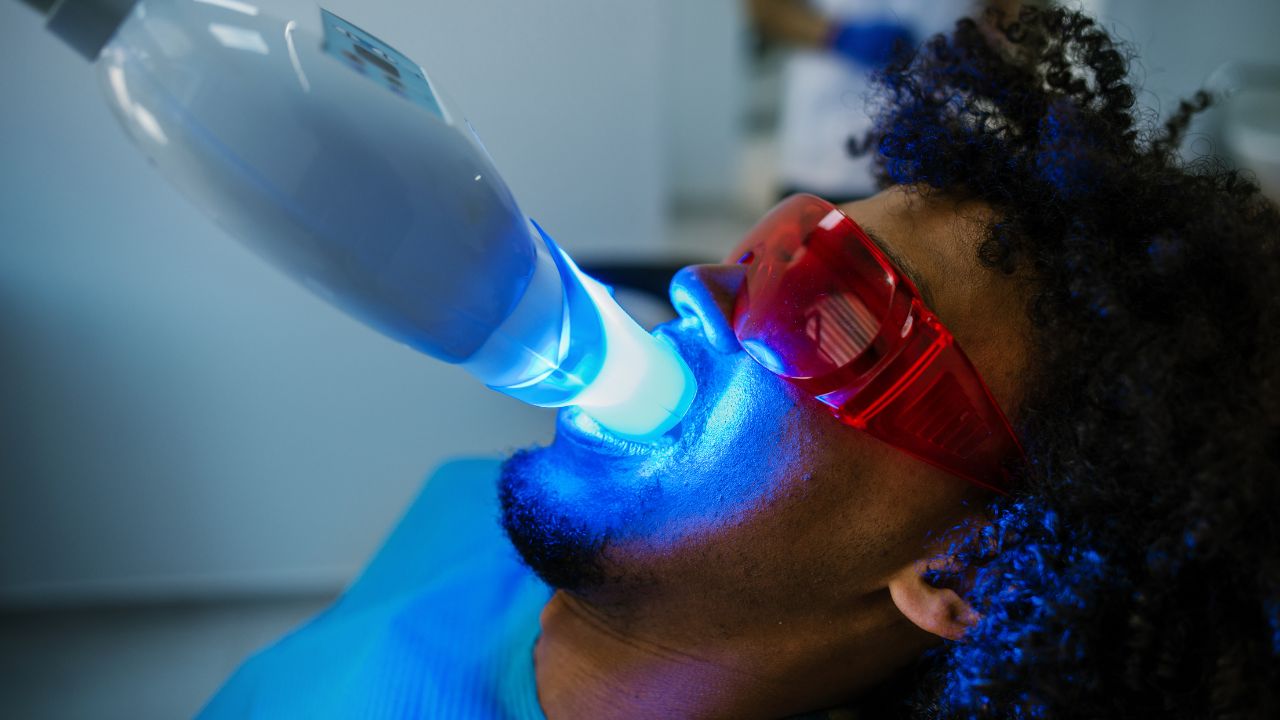 man getting Teeth whitening procedure