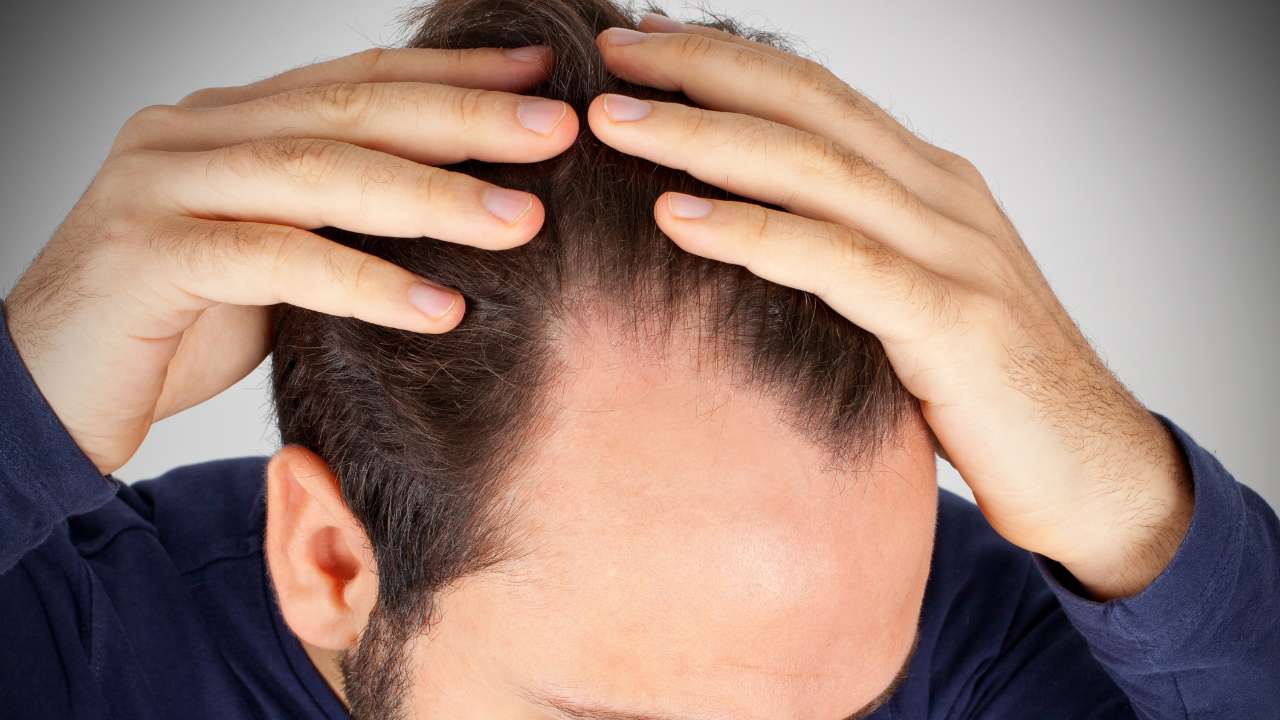 Hair Loss