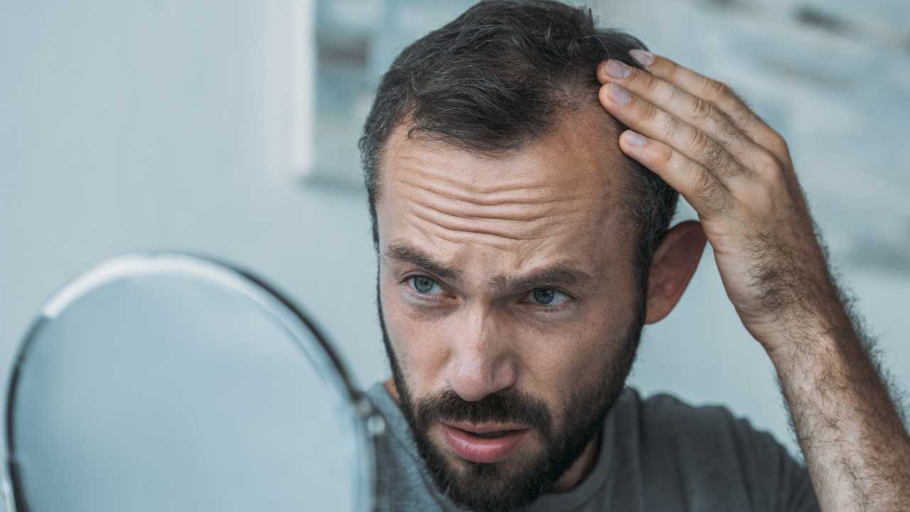 guy facing Hair Loss