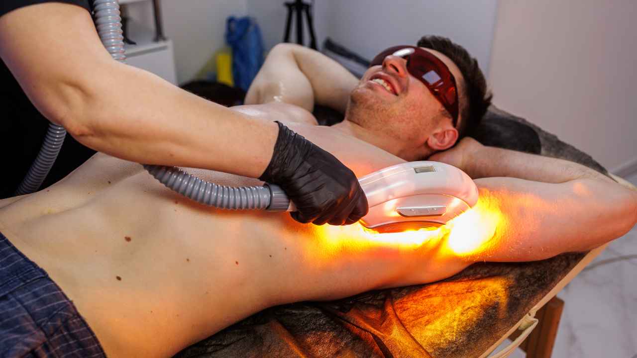 removing a mans armpit hair with laser