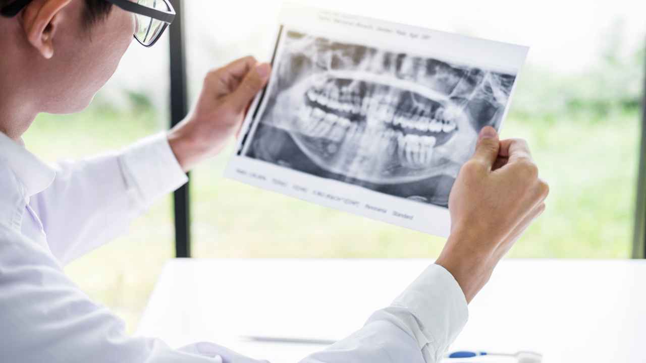 male doctor looking at dental xray