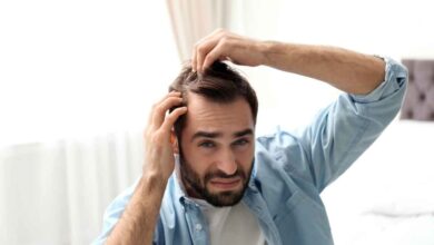 a guy concerned about his Thinning Hair